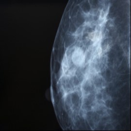 Breast Cancer Year in Review Banner